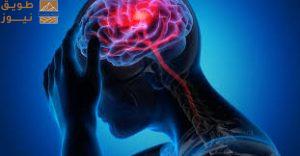 Read more about the article يجب التصرُّف بسرعة.. طبيب يقدّم طريقة بسيطة لكشف الإصابة بجلطة دماغية