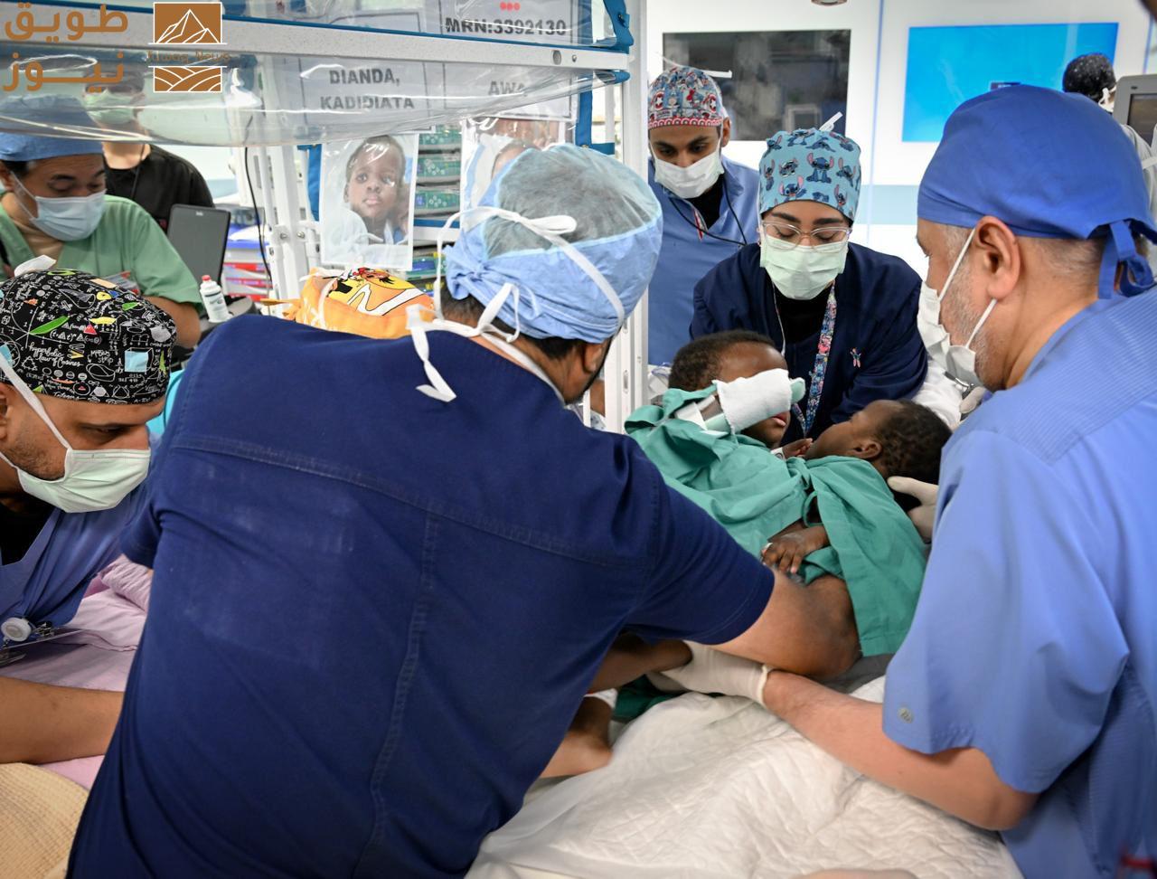 You are currently viewing إنفاذًا لتوجيهات القيادة الرشيدة.. بدء عملية فصل التوأم السيامي البوركيني “حوى وخديجة”