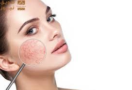 Read more about the article لا تشخيص ولا علاج دون استشارة طبيب.. متى يكون الطفح الجلدي على الوجه مشكلة بسيطة أو علامة على مرض خفي؟