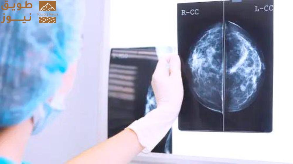 You are currently viewing دواء جديد لإبطاء تطوّر سرطان الثدي