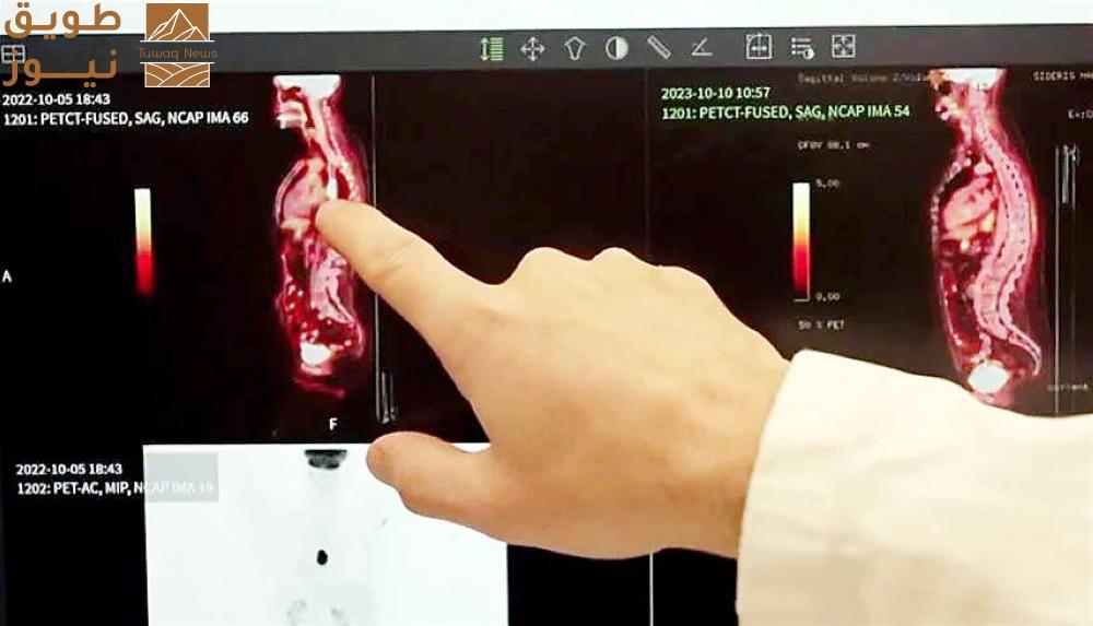 You are currently viewing علاج جديد يفتت الخلايا السرطانية بالأشعة تحت الحمراء