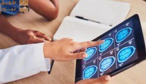 Read more about the article باحثون أستراليون يحققون تقدمًا في علاج أورام الدماغ منخفضة الدرجة