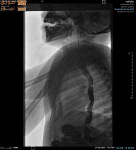 Read more about the article مدينة الملك فهد الطبية: منظار غير جراحي يُعيد الحياة لطفلة الـ 4 سنوات