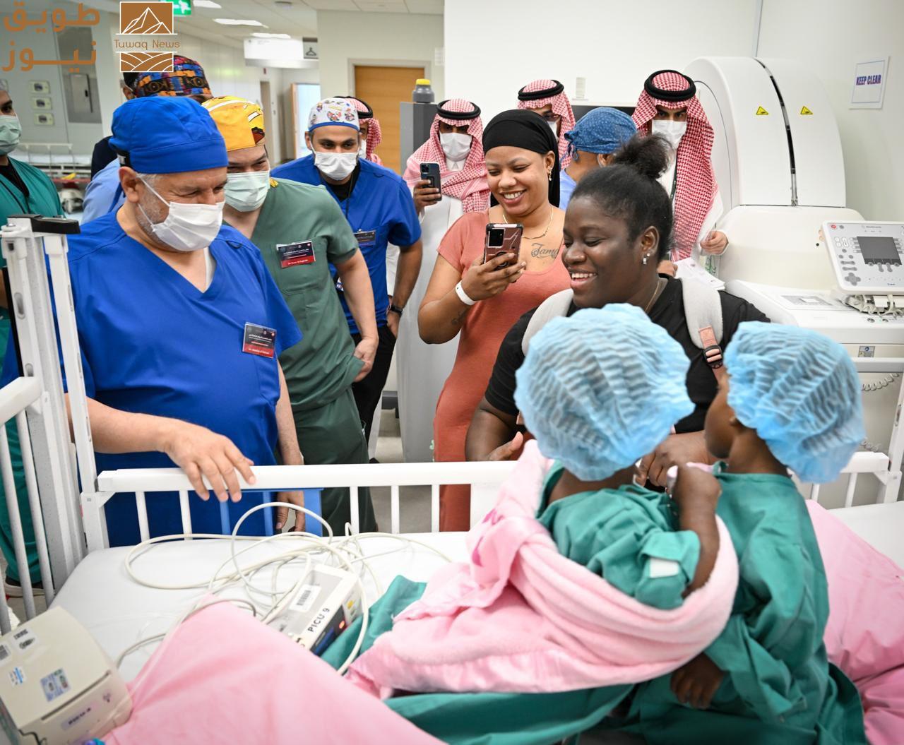 You are currently viewing نجاح فصل التوأم الملتصق الجامايكي «أزاريا وأزورا» بالرياض