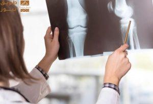 Read more about the article طريقة جديدة للكشف المبكر عن هشاشة العظام
