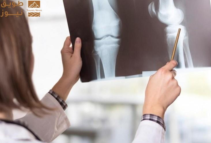 You are currently viewing طريقة جديدة للكشف المبكر عن هشاشة العظام