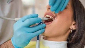 Read more about the article نزيف اللثة وفقدان الأسنان.. ما علاقتها بسرطان الأمعاء؟