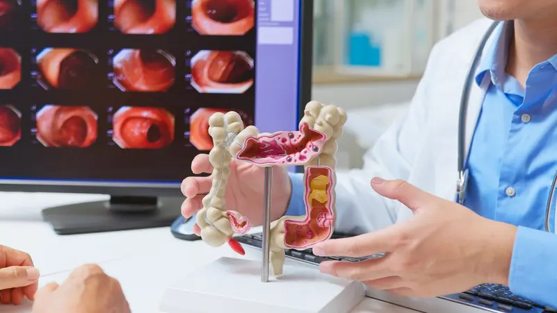 Read more about the article أدوية شائعة للقولون العصبي تحت المجهر